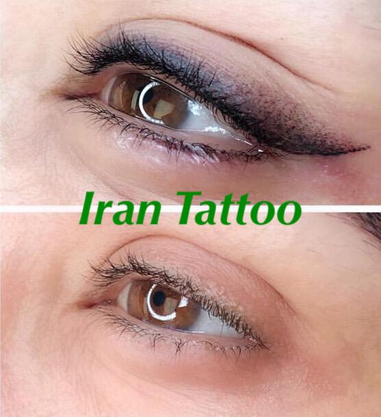 تاتو صورت (ابرو و لب)